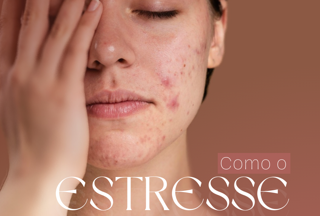 Como o estresse afeta a sua pele